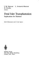 Fetal islet transplantation : Implications for diabetes